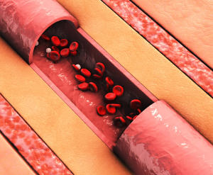 Detoxifies Blood